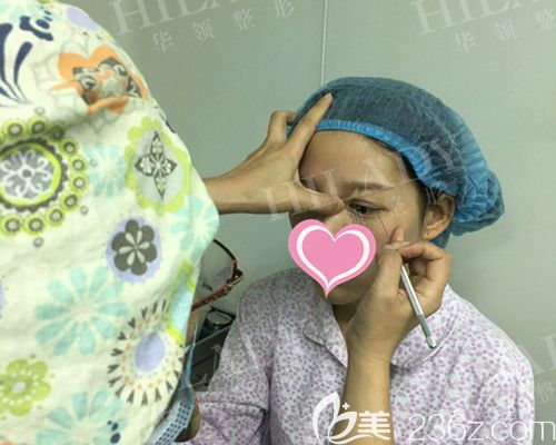 雙眼皮手術(shù)設(shè)計(jì)中 雙眼皮手術(shù)設(shè)計(jì)中