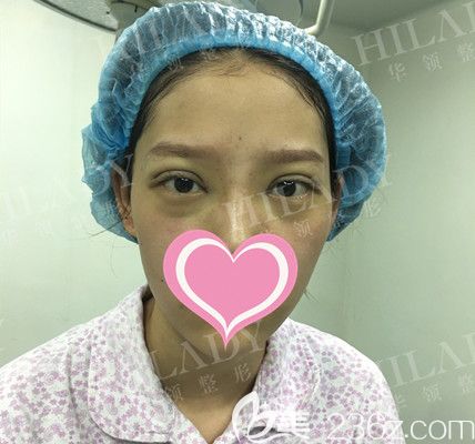 術(shù)后即刻 術(shù)后即刻