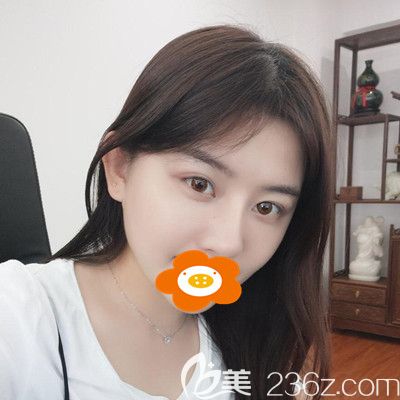 臉部做埋線提升的親身經(jīng)歷總結(jié)：手術很安全術后也沒有后遺癥