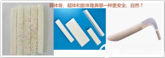 異體骨、超體和膨體區(qū)別對(duì)比