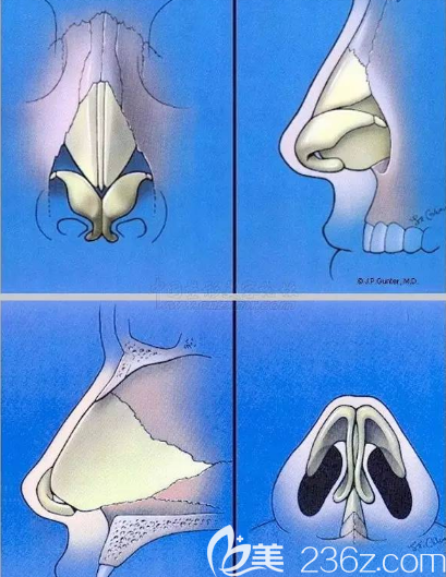 鼻子整體的內(nèi)部構(gòu)造圖