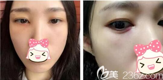 現在眼睛發(fā)紅