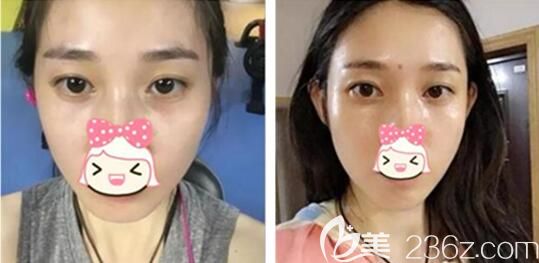 運動完出很多汗