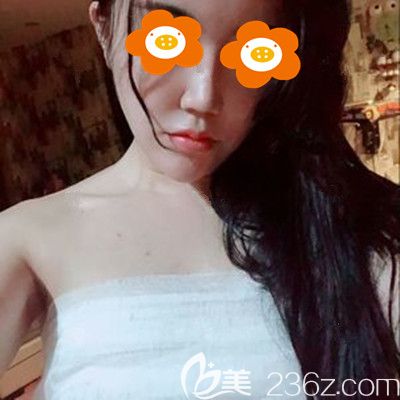 術(shù)后3天胸部還纏著紗布 術(shù)后3天胸部還纏著紗布