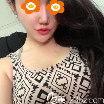 術(shù)后1個(gè)月胸還有點(diǎn)硬 術(shù)后1個(gè)月胸還有點(diǎn)硬