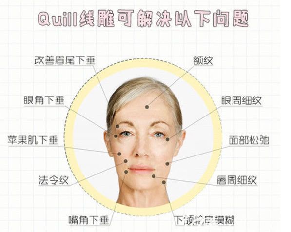 快翎線可以解決哪些面部衰老問題
