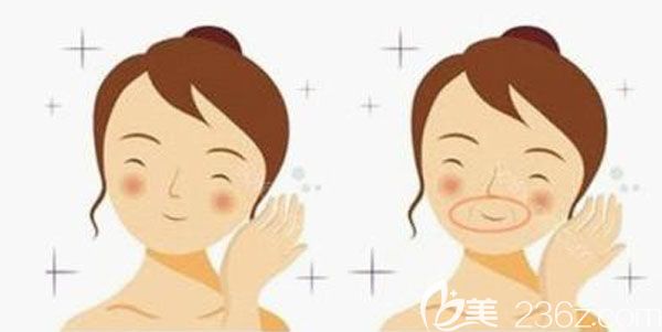 面部年輕化手術方法有哪些 面部年輕化手術方法有哪些