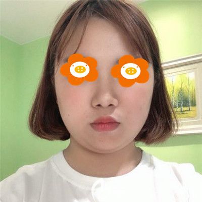 做手術前我的照片 做手術前我的照片