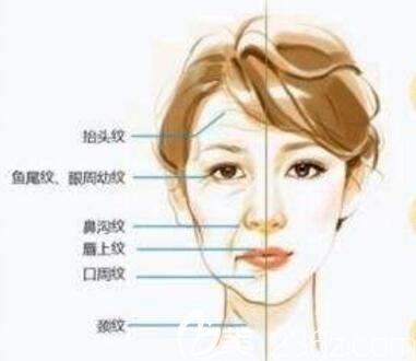 面部衰老部位