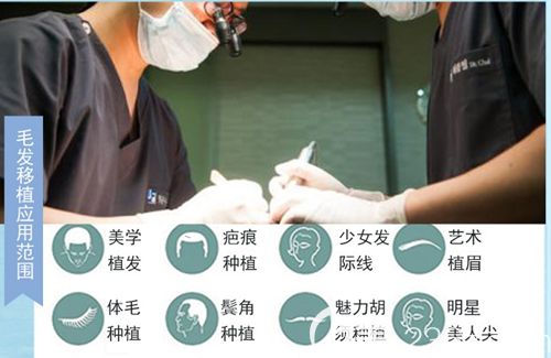 開展了多種毛發(fā)種植項目