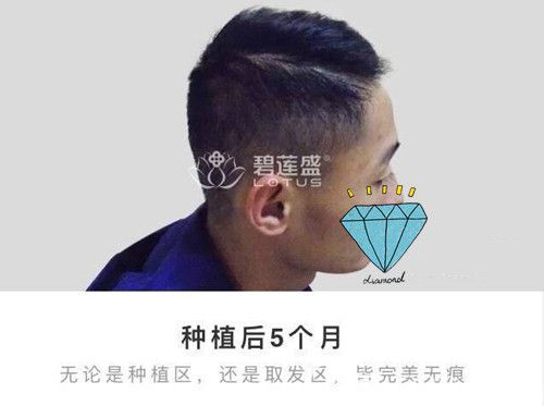 無論是種植區(qū)還是取發(fā)區(qū)都已經(jīng)無痕恢復(fù) 無論是種植區(qū)還是取發(fā)區(qū)都已經(jīng)無痕恢復(fù)