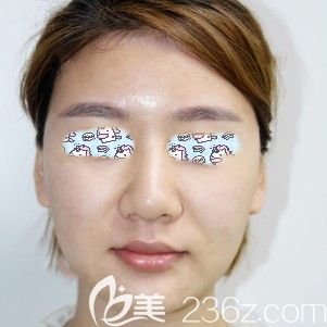 青春正年少皮膚卻松弛 青春正年少皮膚卻松弛