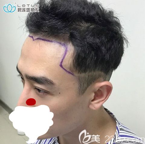 醫(yī)生根據(jù)我的審美畫的設計圖 醫(yī)生根據(jù)我的審美畫的設計圖