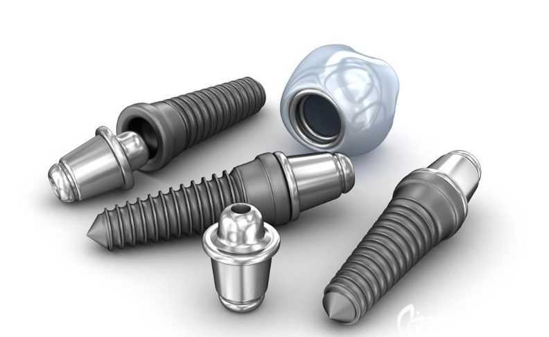 4d種植牙多少錢一顆 4d種植牙多少錢一顆