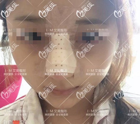 鼻綜合術(shù)后第二天