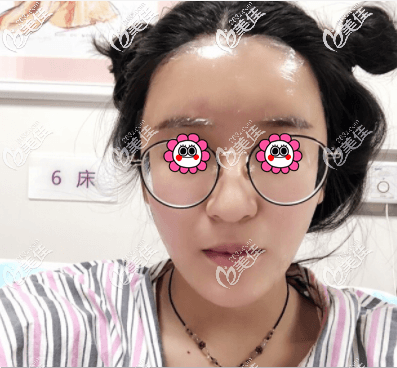 做完手術(shù)后頭一日 做完手術(shù)后頭一日