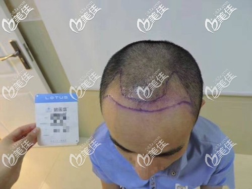 醫(yī)生為我設(shè)計種植區(qū)域