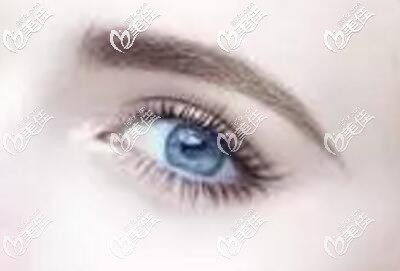 越來越多的人通過做雙眼皮術改善單眼皮