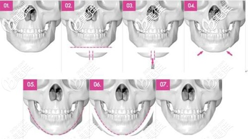 20200330_1585532321730957.jpg u=970704307,429534407&fm=26&gp=0.jpg