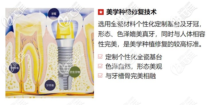 美學(xué)種植科技術(shù) 美學(xué)種植科技術(shù)