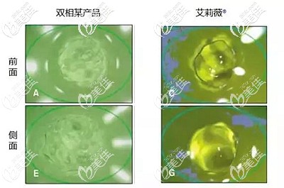 艾莉薇玻尿酸的優(yōu)勢(shì) 艾莉薇玻尿酸的優(yōu)勢(shì)
