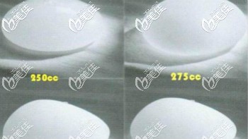 隆胸假體250和275cc大小對比