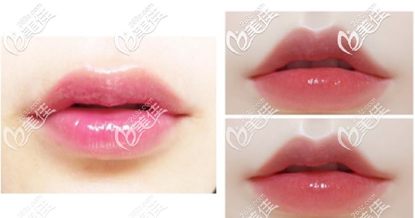 嘟嘟唇圖片 嘟嘟唇圖片