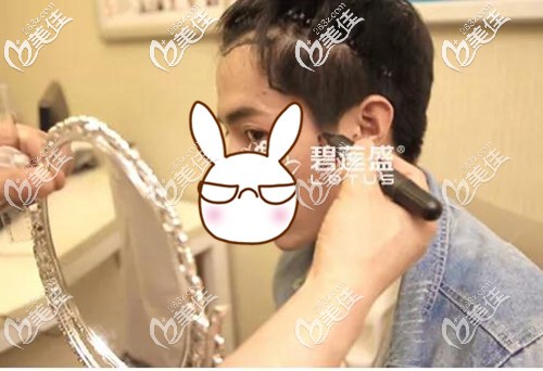 醫(yī)生給我設(shè)計了發(fā)際線加鬢角種植方案