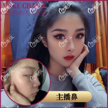 成都美綻美主播鼻