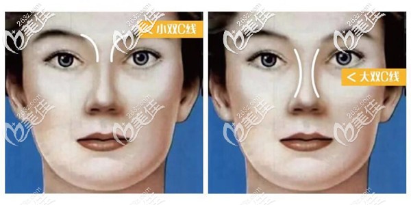 雙c線鼻子效果 雙c線鼻子效果
