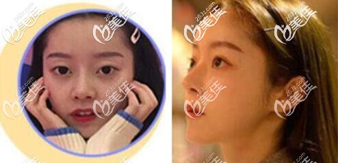 成都潤美玉之光隆鼻好的醫(yī)生是哪個