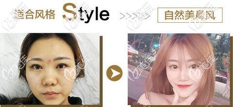 成都銅雀臺自然風隆鼻