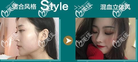 成都隆鼻好的醫(yī)院銅雀臺