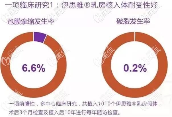 伊思雅包膜攣縮發(fā)生了較低 伊思雅包膜攣縮發(fā)生了較低