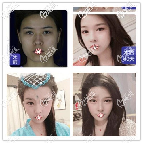 四川友誼醫(yī)院誰磨骨好 四川友誼醫(yī)院誰磨骨好