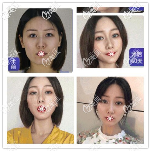 20200410_1586489942365233.jpg 20200410_1586489942365233.jpg