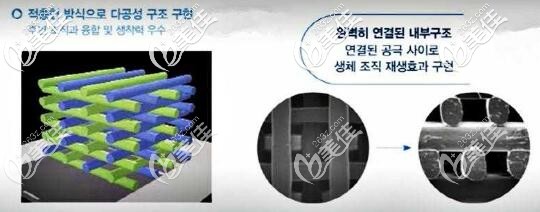 mesh隆鼻材料圖解 mesh隆鼻材料圖解