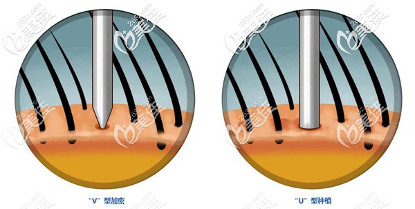 lattic加密種植技術(shù) 優(yōu)勢(shì) lattic加密種植技術(shù) 優(yōu)勢(shì)