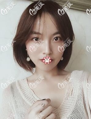 泰國(guó)然禧Yanhee醫(yī)院磨骨比國(guó)內(nèi)和韓國(guó)要便宜而且變性手術(shù)牛是我去的主要原因