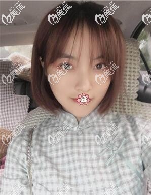 臉真的變小了很多