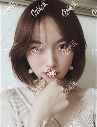 在泰國然禧醫(yī)院做顴骨內(nèi)推+下頜角花了不到六萬