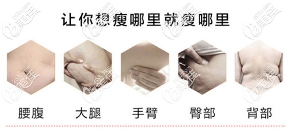 水動(dòng)力吸脂適合的部位 水動(dòng)力吸脂適合的部位