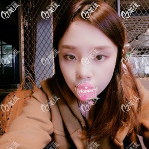 術(shù)前鼻子塌平 術(shù)前鼻子塌平