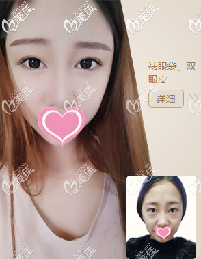 北京畫美真人案例圖1