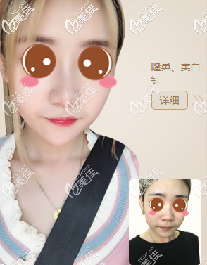 北京畫美真人案例圖2