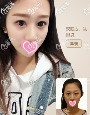 北京畫美真人案例圖3