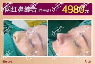 海南華美網(wǎng)紅鼻綜合真人案例圖