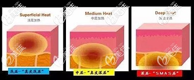 熱拉提的主要作用 熱拉提的主要作用