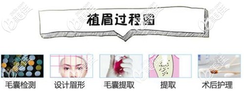 眉毛移植手術(shù)過程圖