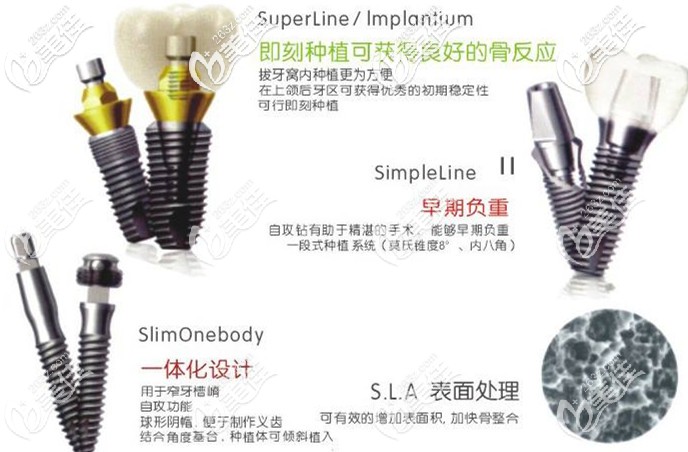 韓國登騰種植體型號的優(yōu)勢